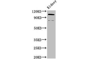 Western Blot Positive WB detected in: Mouse kidney tissue All lanes: ACTN4 antibody at 3. (alpha Actinin 4 antibody  (AA 6-277))