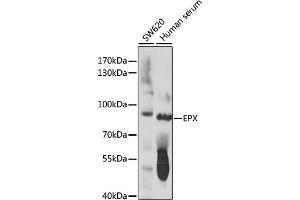 Western blot analysis of extracts of various cell lines, using EPX antibody (ABIN7266966) at 1:1000 dilution. (EPX antibody  (AA 400-500))
