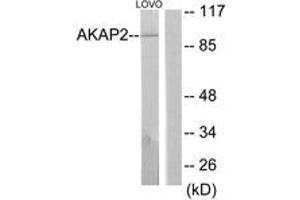 Western Blotting (WB) image for anti-A Kinase (PRKA) Anchor Protein 2 (AKAP2) (AA 71-120) antibody (ABIN2889820) (AKAP2 antibody  (AA 71-120))