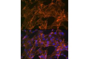 Immunofluorescence analysis of NIH-3T3 cells using α-Actinin-4 Rabbit mAb (ABIN7265399) at dilution of 1:100 (40x lens). (alpha Actinin 4 antibody)