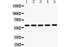 Western Blotting (WB) image for anti-Cystathionine-beta-Synthase (CBS) (AA 331-551) antibody (ABIN3043747) (CBS antibody  (AA 331-551))