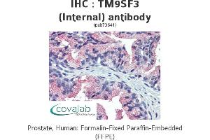 Image no. 1 for anti-Transmembrane 9 Superfamily Member 3 (TM9SF3) (Internal Region), (N-Term) antibody (ABIN1740140) (TM9SF3 antibody  (Internal Region, N-Term))