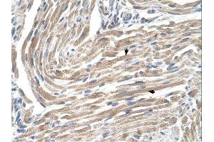 MGST2 antibody was used for immunohistochemistry at a concentration of 4-8 ug/ml.