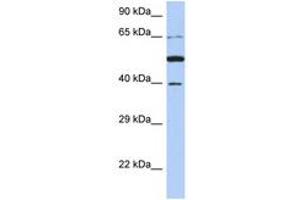 Image no. 1 for anti-Paraneoplastic Antigen MA3 (PNMA3) (AA 71-120) antibody (ABIN6743786) (PNMA3 antibody  (AA 71-120))