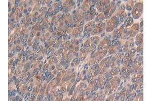 Detection of Slit3 in Mouse Stomach Tissue using Polyclonal Antibody to Slit Homolog 3 (Slit3) (SLIT3 antibody  (AA 1348-1517))