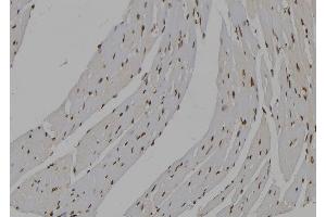 ABIN6277535 at 1/100 staining Mouse heart tissue by IHC-P. (IMPDH2 antibody  (Internal Region))