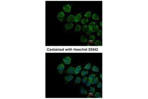 ICC/IF Image Immunofluorescence analysis of methanol-fixed Hep3B, using IFNAR2, antibody at 1:500 dilution. (IFNAR2 antibody  (Center))