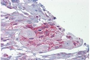 Anti-ASPH antibody IHC staining of human small intestine and myenteric plexus. (Aspartate beta Hydroxylase antibody  (AA 107-156))