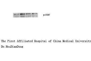 Western Blot (WB) analysis: Please contact us for more details. (STAT1 antibody  (pTyr701))