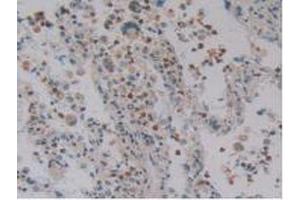 Figure. (DEFA4 antibody  (AA 23-97))