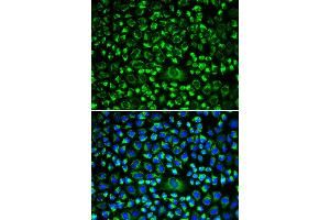Immunofluorescence analysis of HeLa cells using TAPBP antibody. (TAPBP antibody)
