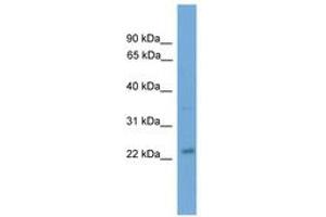 Image no. 1 for anti-BCL2 Binding Component 3 (BBC3) (AA 21-70) antibody (ABIN6745469) (PUMA antibody  (AA 21-70))