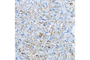 Immunohistochemistry of paraffin-embedded rat ovary using Aromatase (CYP19) antibody (2684) at dilution of 1:100 (40x lens). (Aromatase antibody  (AA 1-180))