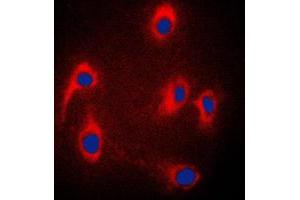 Immunofluorescent analysis of JIP3 staining in PC12 cells. (JIP3 antibody  (Center))