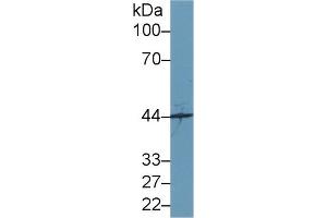 Detection of SYTL2 in Mouse Cerebrum lysate using Polyclonal Antibody to Synaptotagmin Like Protein 2 (SYTL2) (SYTL2 antibody  (AA 329-880))