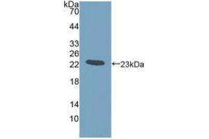 Western blot analysis of recombinant Human GREM1. (GREM1 antibody  (AA 26-184))