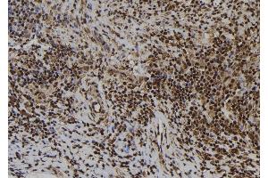 ABIN6273425 at 1/100 staining Human spleen tissue by IHC-P. (ATRAID antibody  (Internal Region))