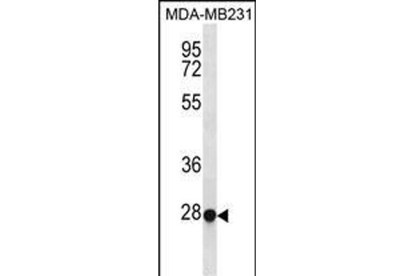 TFEC anticorps  (AA 179-205)