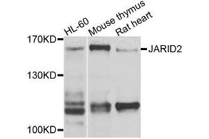 Western blot analysis of extracts of various cell lines, using JARID2 antibody (ABIN6003555) at 1/1000 dilution. (JARID2 antibody)
