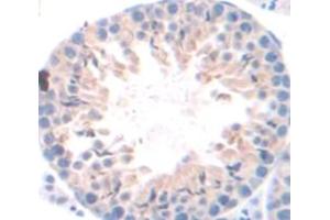 Figure. (FAM135B antibody  (AA 1068-1403))