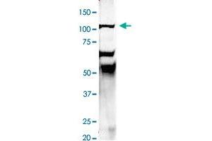 Immunoprecipitation of rat brain homogenate with EEA1 polyclonal antibody  at 1:500 dilution.