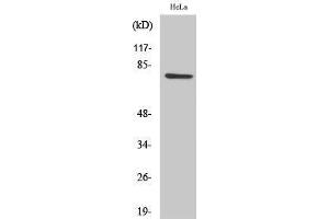Western Blotting (WB) image for anti-Centrosomal Protein 78kDa (CEP78) (Internal Region) antibody (ABIN3174350) (CEP78 antibody  (Internal Region))