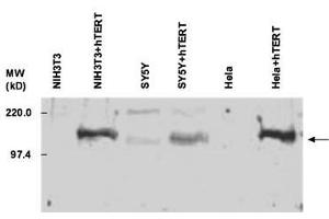Anti-hTERT Anitbody - Western Blot. (TERT antibody  (C-Term))