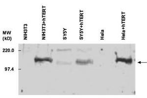 TERT antibody  (C-Term)