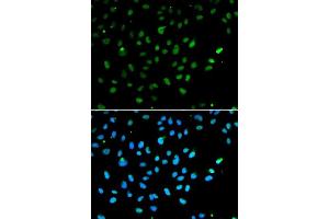 Immunofluorescence analysis of A549 cells using SMARCA4 antibody.