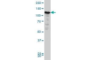 NOPE monoclonal antibody (M03), clone 6E6 Western Blot analysis of NOPE expression in HeLa . (IGDCC4 antibody  (AA 1152-1250))