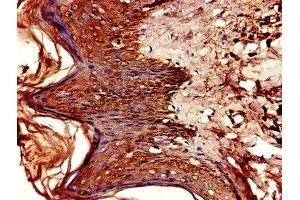 Immunohistochemistry of paraffin-embedded human skin tissue using ABIN7154406 at dilution of 1:100 (CSF2RA antibody  (AA 23-320))