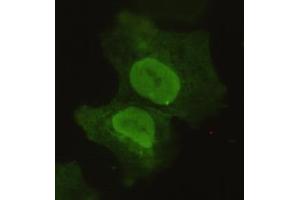 Immunocytochemistry of COS7 cells using anti-Sox2 mouse mAb diluted 1:150. (SOX2 antibody)