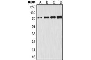 Western blot analysis of GCLC expression in HeLa (A), A431 (B), Jurkat (C), HepG2 (D) whole cell lysates. (GCLC antibody  (Center))
