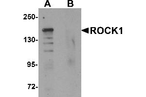 Western blot analysis of ROCK1 in 293 cell lysate with ROCK1 antibody at 1 µg/mL in (A) the absence and (B) the presence of blocking peptide. (ROCK1 antibody  (N-Term))