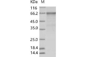 Western Blotting (WB) image for Enterovirus D68 VP1 (EV-D68 VP1) protein (Fc Tag) (ABIN7198708)