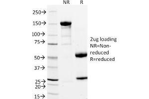 SDS-PAGE Analysis Purified StAR Mouse Monoclonal Antibody (STAR/2154). (STAR antibody  (AA 39-108))