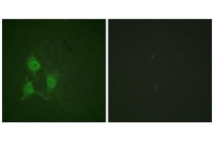 Immunofluorescence (IF) image for anti-PKA alpha/beta Cat (pThr197) antibody (ABIN1847296) (PKA alpha/beta Cat (pThr197) antibody)