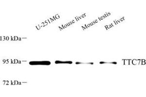 Western blot analysis of TTC7B (ABIN7075876) at dilution of 1: 500 (TTC7B antibody)