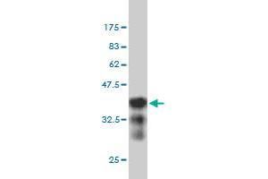 Western Blot detection against Immunogen (36. (NCAPH antibody  (AA 645-741))