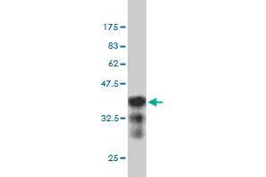 Western Blot detection against Immunogen (36. (NCAPH antibody  (AA 645-741))