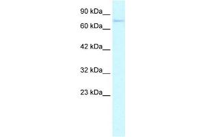 Human HepG2; WB Suggested Anti-ZNF336 Antibody Titration: 0.