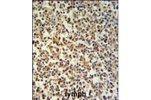 Immunohistochemistry (Paraffin-embedded Sections) (IHC (p)) image for anti-Granzyme B (GZMB) (AA 175-203), (C-Term) antibody (ABIN390496)