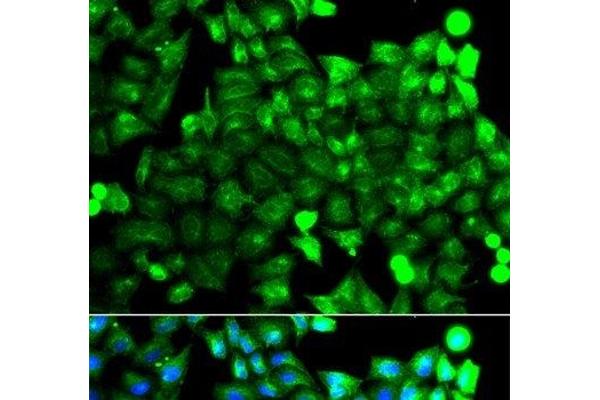 NCALD antibody