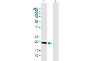 Western Blot analysis of HBXIP expression in transfected 293T cell line by HBXIP MaxPab polyclonal antibody. (HBXIP antibody  (AA 1-173))
