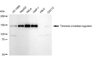 Western blotting analysis using Timeless circadian regulator antibody (ABIN7800558).