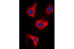 Immunofluorescent analysis of CDCA3 staining in MCF7 cells.