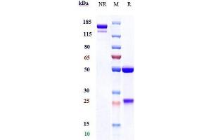 Anti-CSF1R / M-CSFR / CD115 Reference Antibody (cabiralizumab) on SDS-PAGE under reducing (R) condition. (Recombinant CSF1R (Cabiralizumab Biosimilar) antibody)