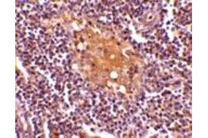 Immunohistochemistry (IHC) image for anti-AIM (C-Term) antibody (ABIN1030228) (AIM (C-Term) antibody)