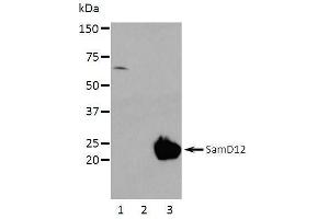 Western Blotting (WB) image for anti-Sterile alpha Motif Domain Containing 12 (SAMD12) (full length) antibody (ABIN2443898) (SAMD12 antibody  (full length))