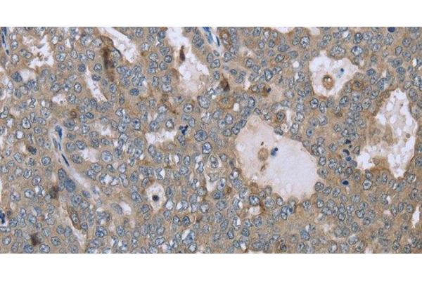 FAR2 antibody